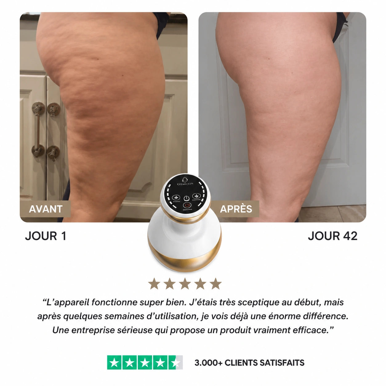 Osmolia™ | Appareil de massage anti-cellulite