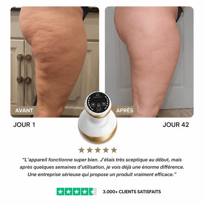 Osmolia™ | Appareil de massage anti-cellulite