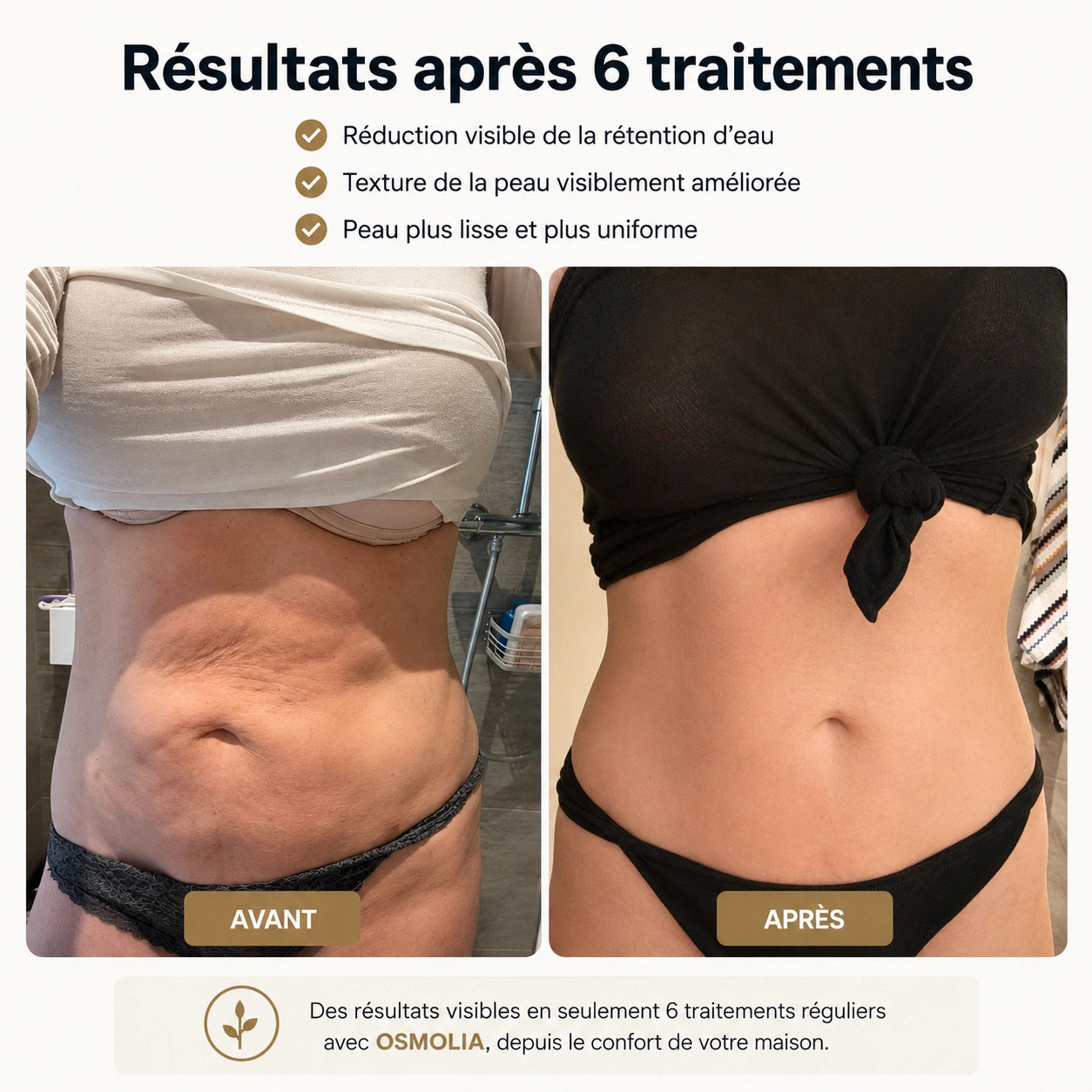 Osmolia™ | Appareil de massage anti-cellulite