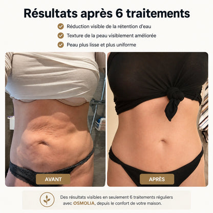 Osmolia™ | Appareil de massage anti-cellulite