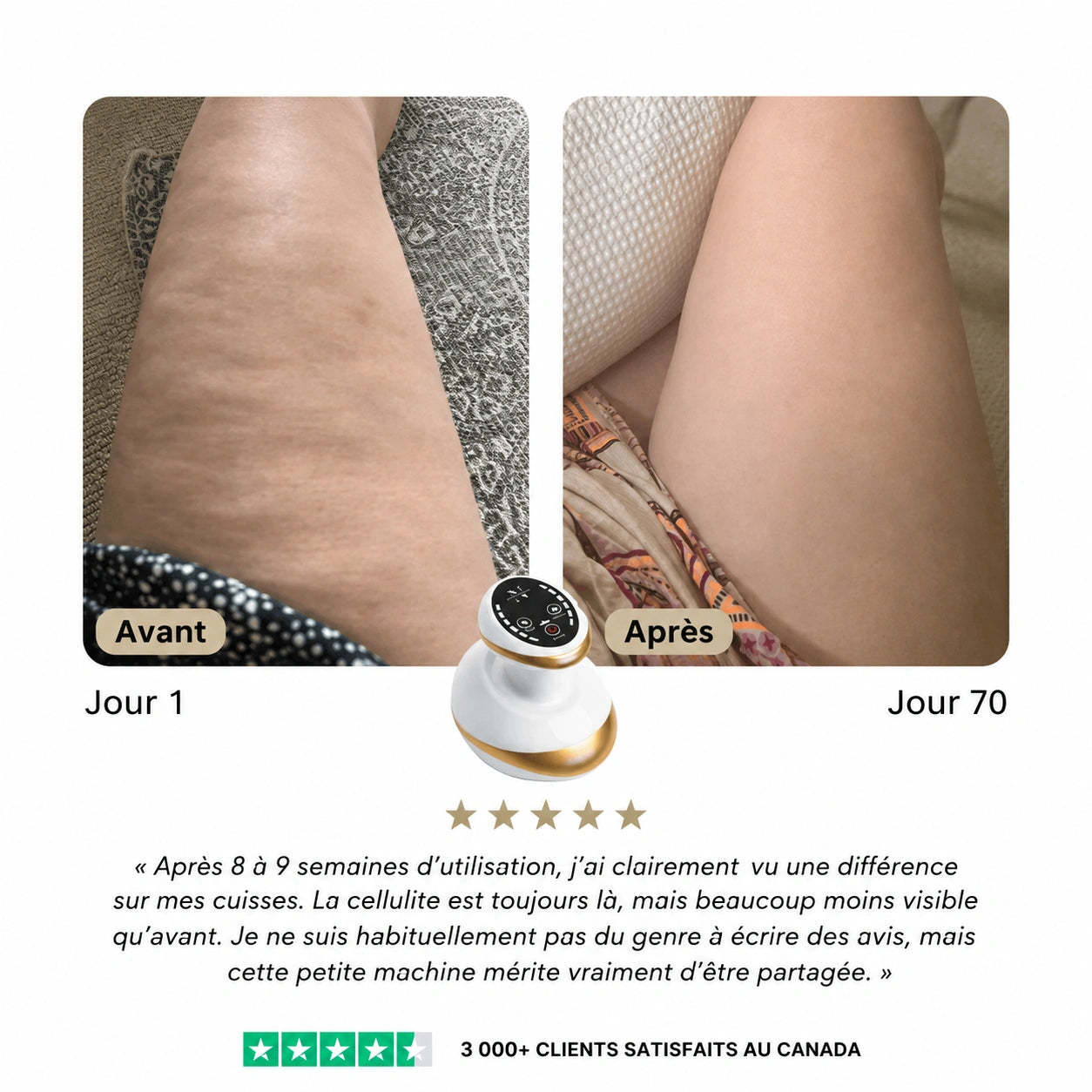 Osmolia™ | Appareil de massage anti-cellulite