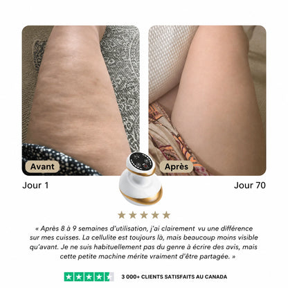Osmolia™ | Appareil de massage anti-cellulite