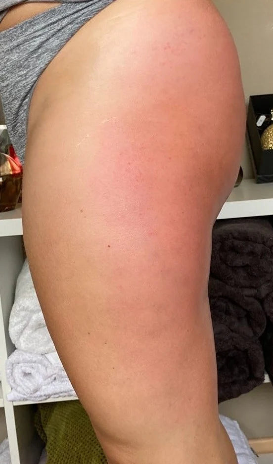 Après